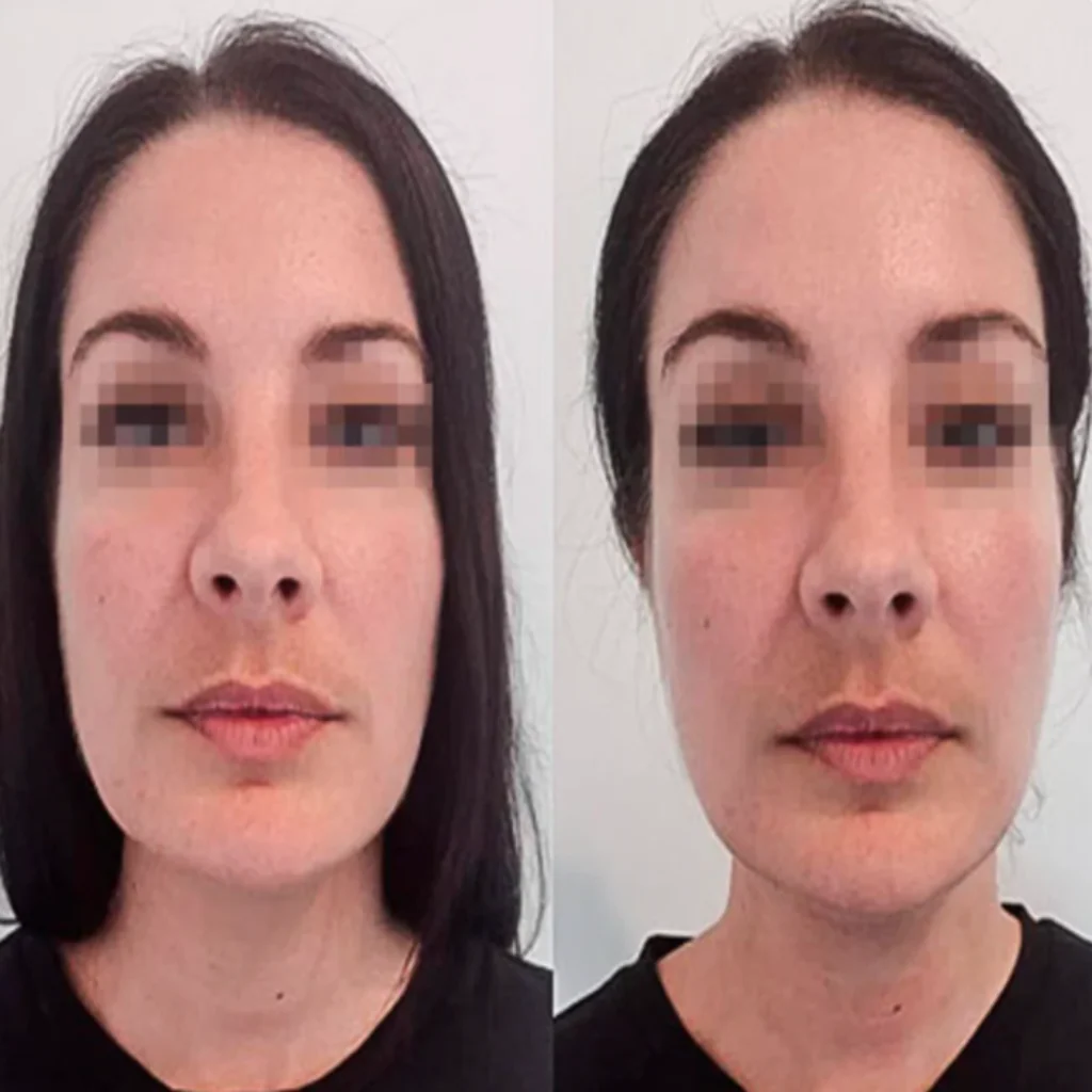 Lymphatic Drainage Drops - Image 3