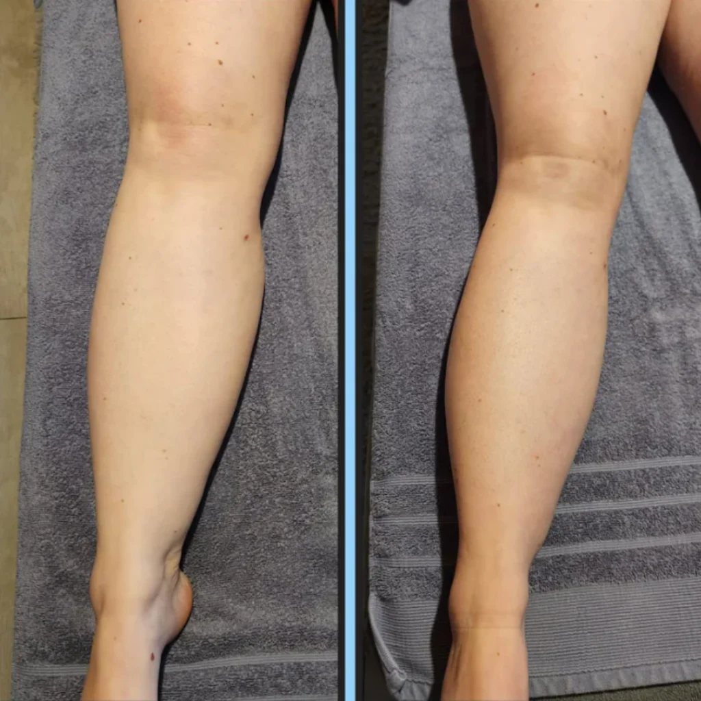 Lymphatic Drainage Drops - Image 5